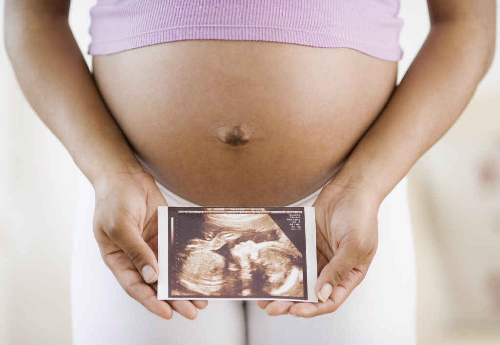 Pregnant woman holding ultrasound printout